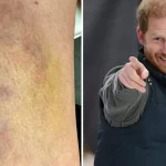 Man Sees Prince Harry with Bruise After Soccer Injury – Friends Call Him ‘The Chosen One’