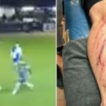Non-league player expresses anger towards referee following serious injury, fans attribute it to ‘Pringle shin-pad’.