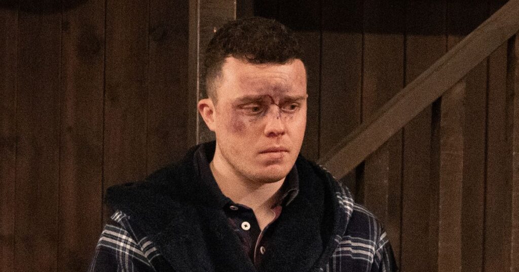 Emmerdale viewers left puzzled by significant Vinny Dingle injury ‘mistake’ following Tom’s attack