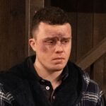Emmerdale viewers left puzzled by significant Vinny Dingle injury ‘mistake’ following Tom’s attack